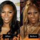 Serena Williams plastic surgery before and after