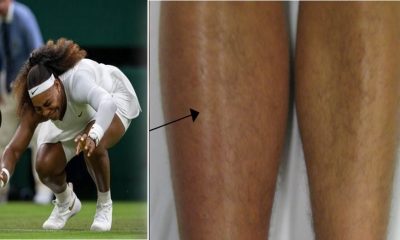 Serena Williams Wimbledon injury