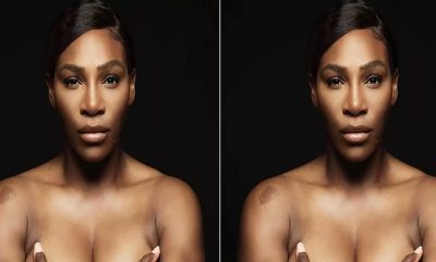 Serena Williams goes topless, promotes Breast Cancer Awareness pics